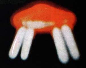 31